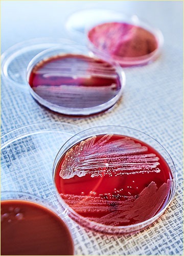 Petri dishes